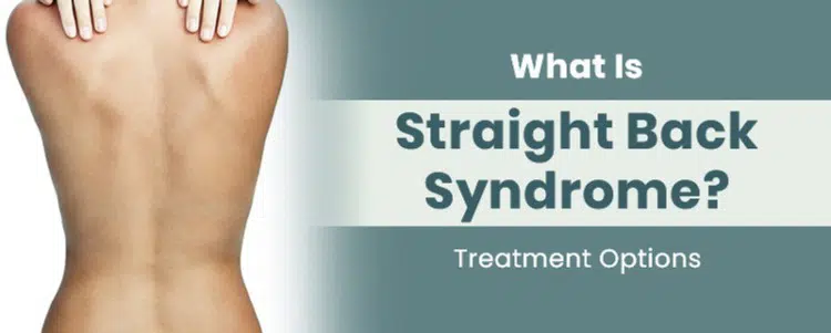 What Is Straight Back Syndrome? Treatment Options