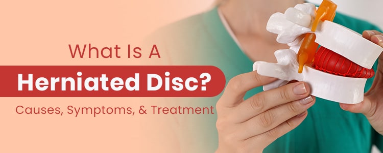 What Is A Herniated Disc? Causes, Symptoms, & Treatment