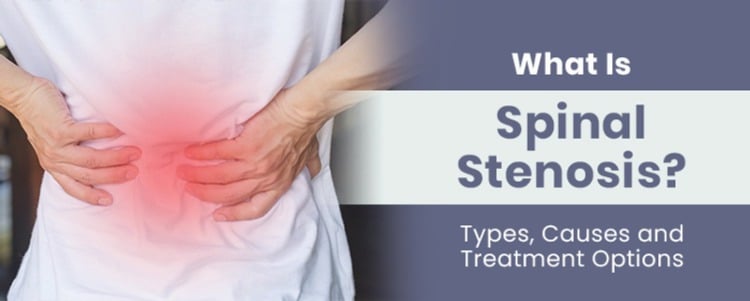 What Is Spinal Stenosis? Types, Causes and Treatment Options