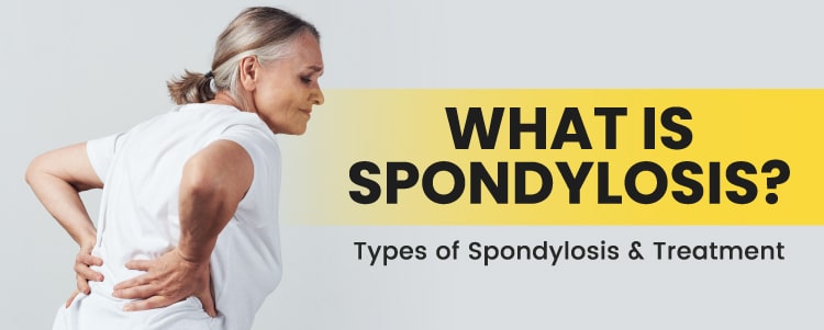 What Is Spondylosis? Types of Spondylosis & Treatment