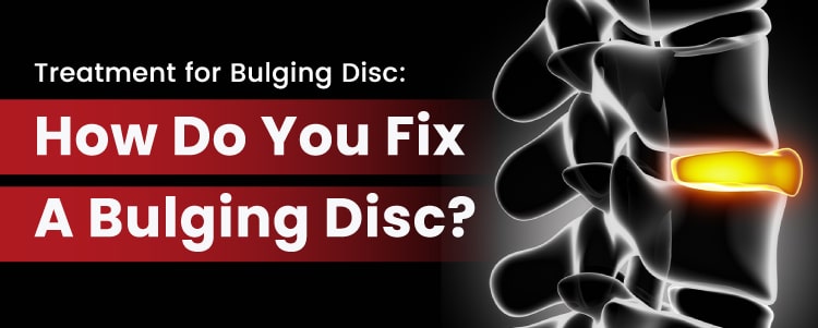 Treatment for Bulging Disc: How Do You Fix A Bulging Disc?