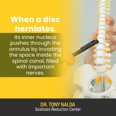 when a disc herniates its inner 400 when a disc herniates its inner 400