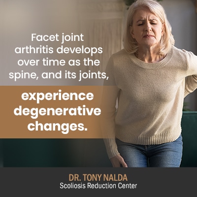 facet joint arthritis develops 400 facet joint arthritis develops 400