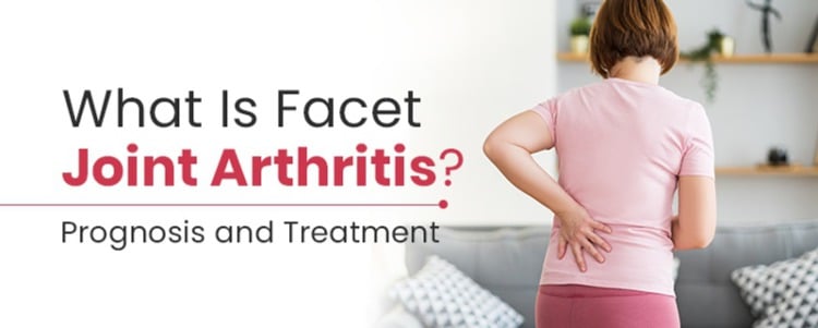 What Is Facet Joint Arthritis? Prognosis and Treatment