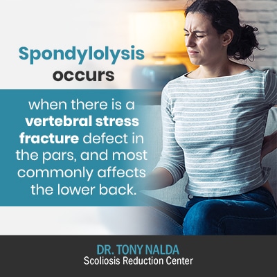 spondylolysis occurs when there is 400