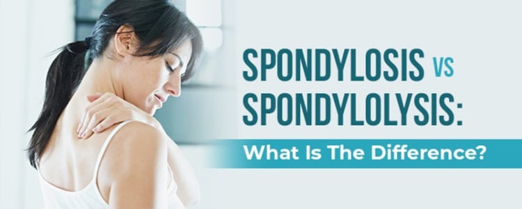spondylosis vs spondylolysis