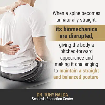 What Is Straight Back Syndrome? Treatment Options