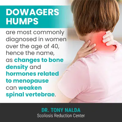 Understanding Dowager's Hump: Causes, Symptoms & Exercises