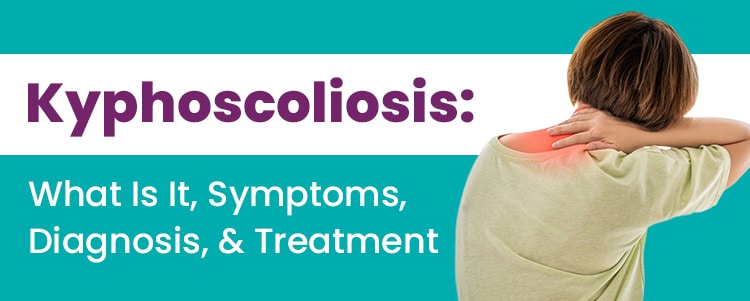 Kyphoscoliosis: What Is It, Symptoms, Diagnosis, & Treatment