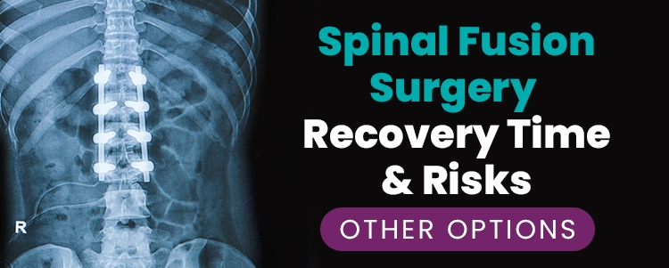 Spinal Fusion Surgery Recovery Time & Risks [OTHER OPTIONS]