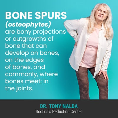 bone spurs osteophytes are bony 400