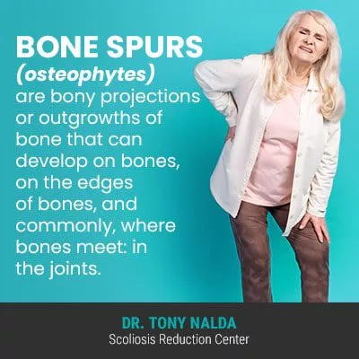 bone spurs osteophytes are bony 400 bone spurs osteophytes are bony 400