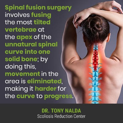 spinal fusion surgery involves 400