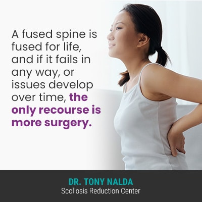 A fused spine is fused 400