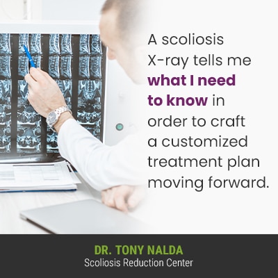 A scoliosis X ray tells me 