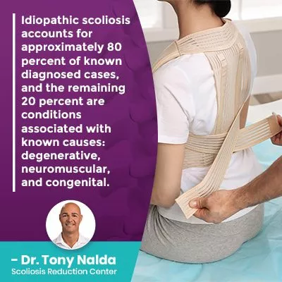 Idiopathic scoliosis accounts for approximately 400 Idiopathic scoliosis accounts for approximately 400