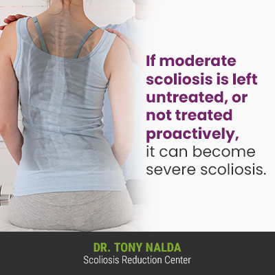 If moderate scoliosis is left 