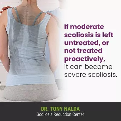 If moderate scoliosis is left 400 If moderate scoliosis is left