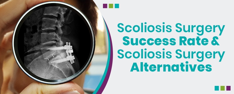 Scoliosis Surgery Success Rate & Scoliosis Surgery Alternatives