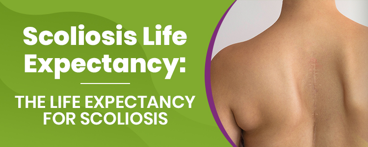 Scoliosis Life Expectancy The Life Expectancy for Scoliosis