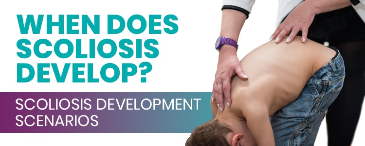 When Does Scoliosis Develop Scoliosis Development Scenarios