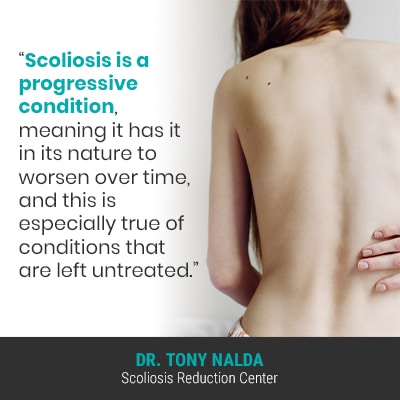 Scoliosis is a progressive condition