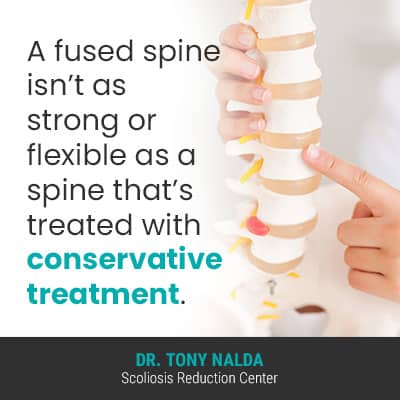 A fused spine isnt as 