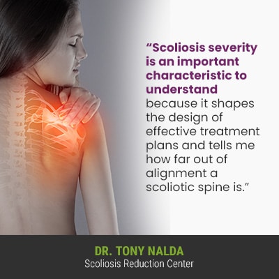 Scoliosis severity is an important characteristic 400