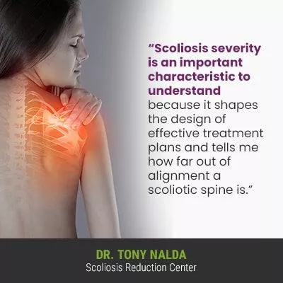 Scoliosis severity is an important characteristic 400 Scoliosis severity is an important characteristic 400