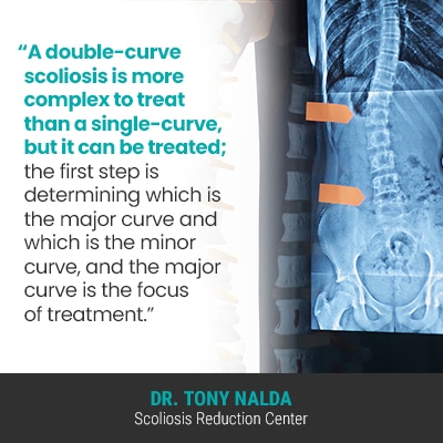 A double curve scoliosis is more 400 A double curve scoliosis is more 400