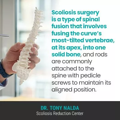 scoliosis surgery is a 400 scoliosis surgery is a 400