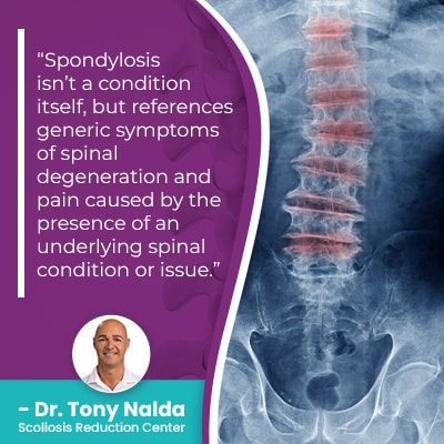 spondylosis isnt a condition 400