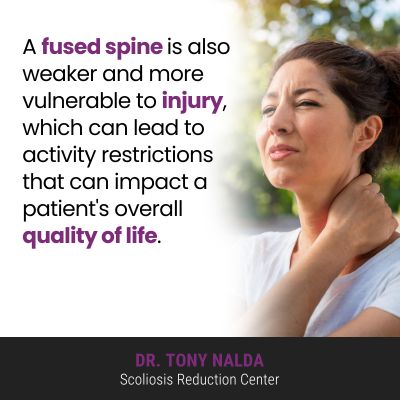 a-fused-spine-is-also-400