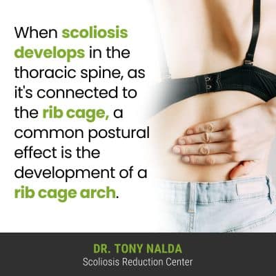 when-scoliosis-develops-in-the-400
