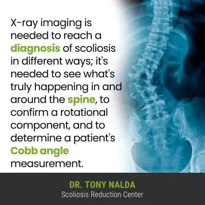 x ray imaging is 400 x ray imaging is 400