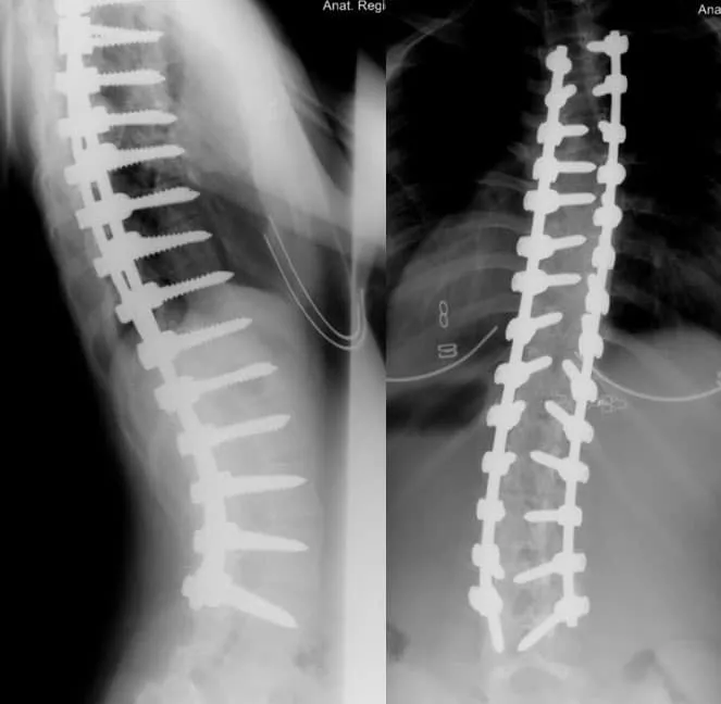 page2-spines