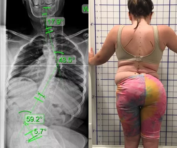 adult-congenital