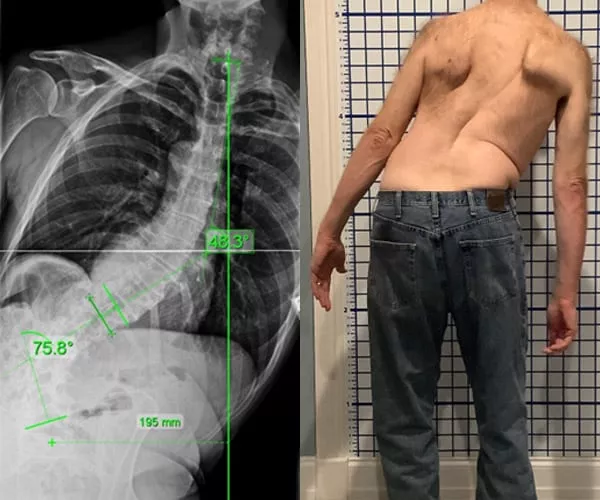 adult-neuromuscular