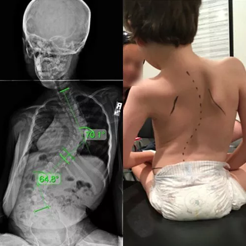 neuromuscular neuromuscular