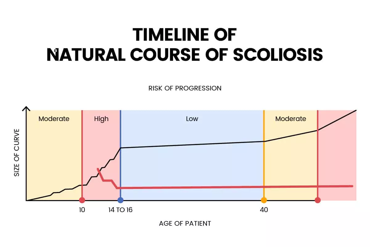 Alternate Progression Model for Adolescents Alternate Progression Model for Adolescents