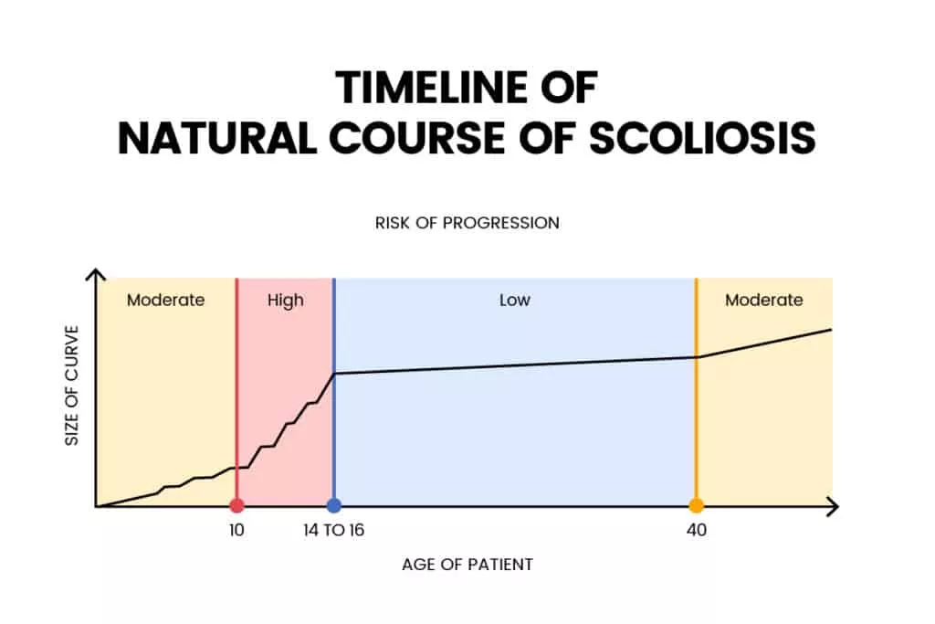timeline of natural course of scoliosis timeline of natural course of scoliosis