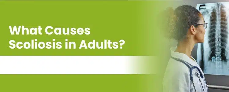What Causes Scoliosis in Adults
