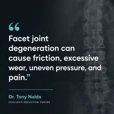 The facet joints connecting vertebrae 400 A visual representation of the quote from the text starting with “The facet joints connecting vertebrae"