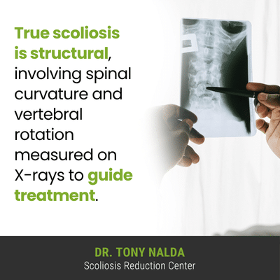 A true scoliosis is structural; the 400 A visual representation of the quote from the text starting with “A true scoliosis is structural; the"