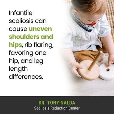 Like congenital scoliosis, the main 400 A visual representation of the quote from the text starting with “Like congenital scoliosis, the main"