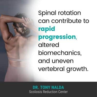 Rotation matters because it can 400 A visual representation of the quote from the text starting with “Rotation matters because it can"